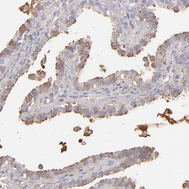 Staining of human fallopian tube shows strong membranous positivity in glandular cells.