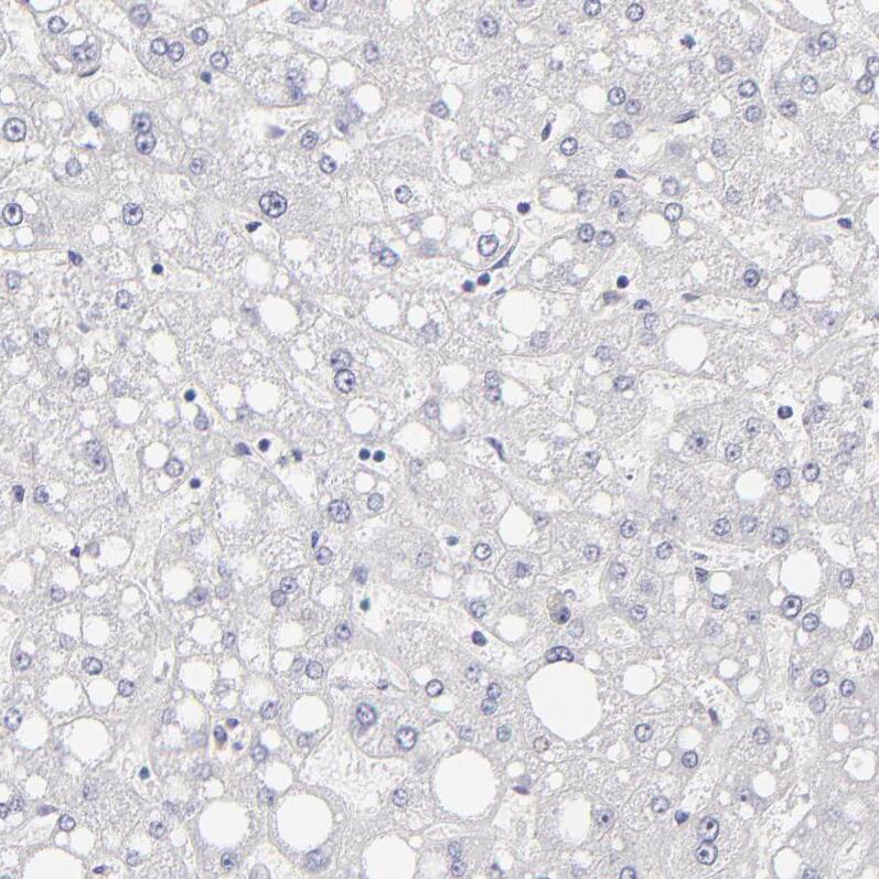 Staining of human liver shows no positivity in hepatocytes as expected.