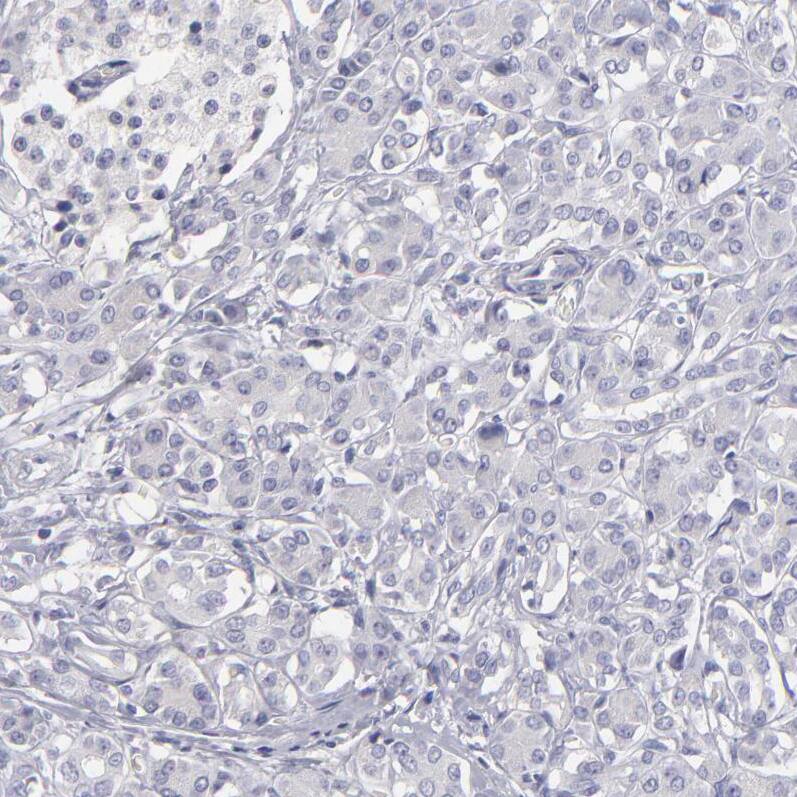 Staining of human pancreas shows no positivity in exocrine glandular cells as expected.