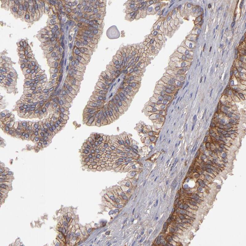 Staining of human prostate shows strong membranous positivity in glandular cells.