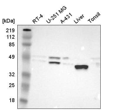 Analysis in human cell line RT-4, human cell line U-251 MG, human cell line A-431, human liver tissue and human tonsil tissue.