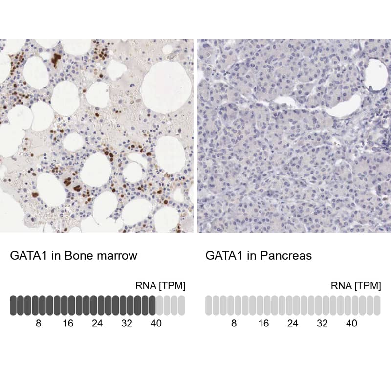 <b>Orthogonal Strategies Validation. </b>Analysis in human bone marrow and pancreas tissues using HPA000232 antibody. Corresponding GATA1 RNA-seq data are presented for the same tissues.