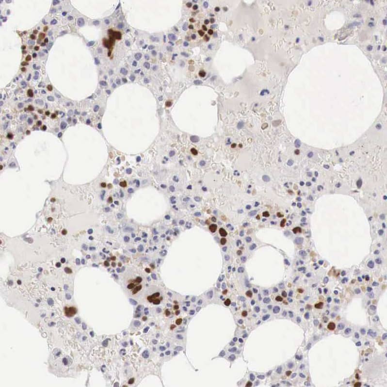 Staining of human bone marrow shows strong nuclear positivity in hematopoietic cells.