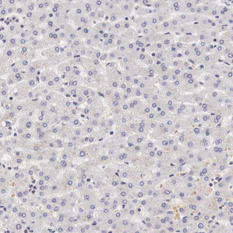 Staining of human liver shows no positivity in hepatocytes as expected.