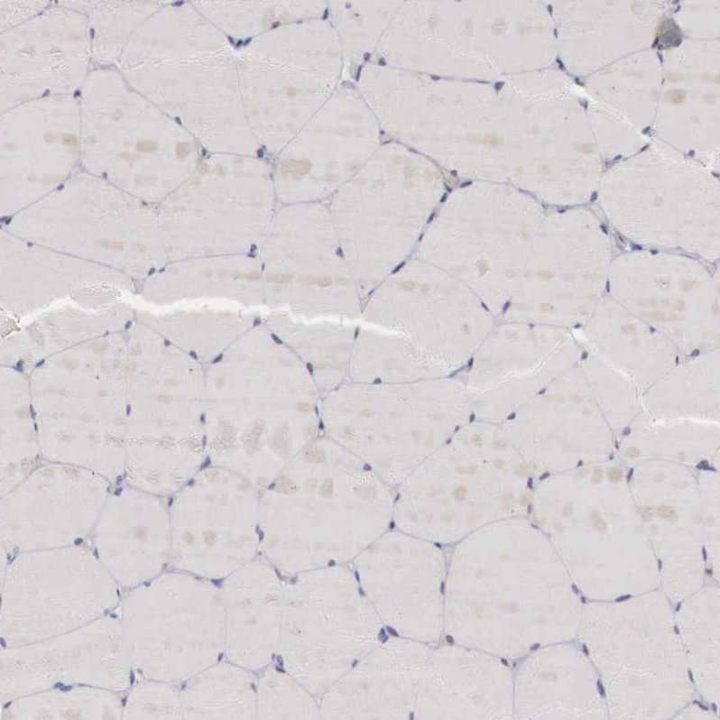 Staining of human skeletal muscle shows no positivity in myocytes as expected.