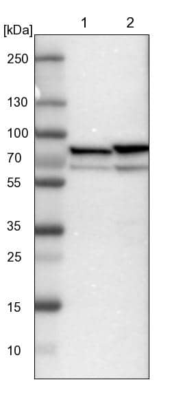 Lane 1: NIH-3T3 cell lysate (Mouse embryonic fibroblast cells)Lane 2: NBT-II cell lysate (Rat Wistar bladder tumour cells)
