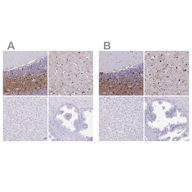 Staining of human cerebellum, cerebral cortex, liver and prostate .