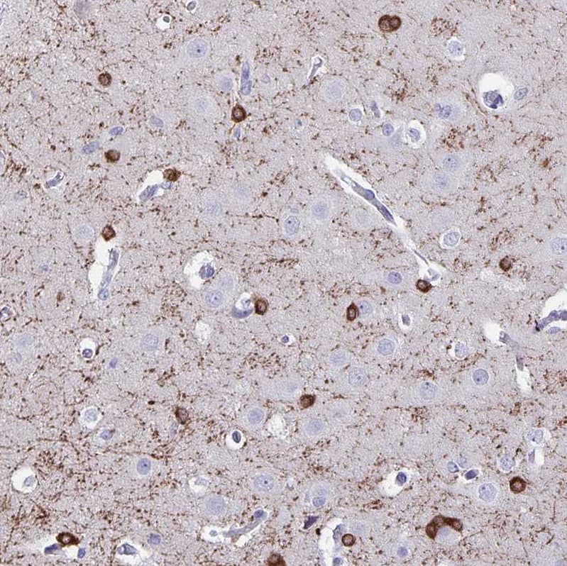 Staining of human cerebral cortex shows strong cytoplasmic positivity in oligodendrocytes.