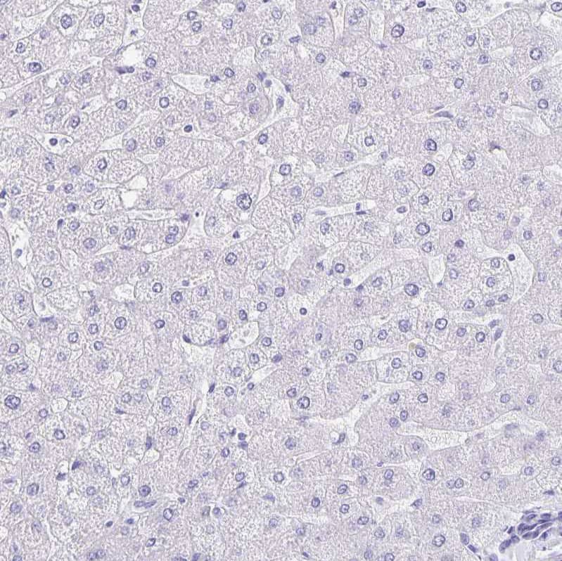 Staining of human liver shows no positivity in hepatocytes as expected.