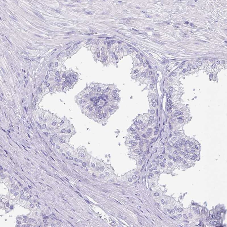 Staining of human prostate shows no positivity in glandular cells as expected.