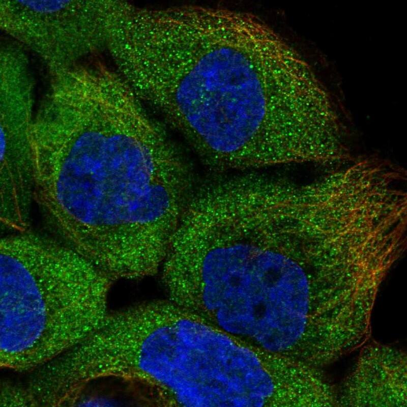 Staining of human cell line A-431 shows localization to cytosol.