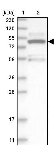 Lane 1: Marker [kDa] 230, 130, 95, 72, 56, 36, 28, 17, 11Lane 2: Human cell line RT-4