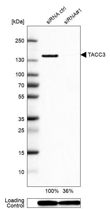 <b>Genetic Strategies Validation. </b>Analysis in HEK293 cells transfected with control siRNA, target specific siRNA probe #1, using Anti-TACC3 antibody. Remaining relative intensity is presented. Loading control: Anti-GAPDH.