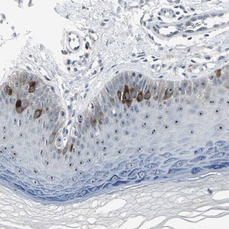 <b>Genetic Strategies Validation. </b>Staining of human skin shows strong nuclear and cytoplasmic positivity in epidermal cells.