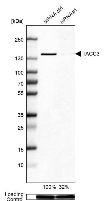 <b>Genetic Strategies Validation. </b>Analysis in HEK293 cells transfected with control siRNA, target specific siRNA probe #1, using Anti-TACC3 antibody. Remaining relative intensity is presented. Loading control: Anti-GAPDH.