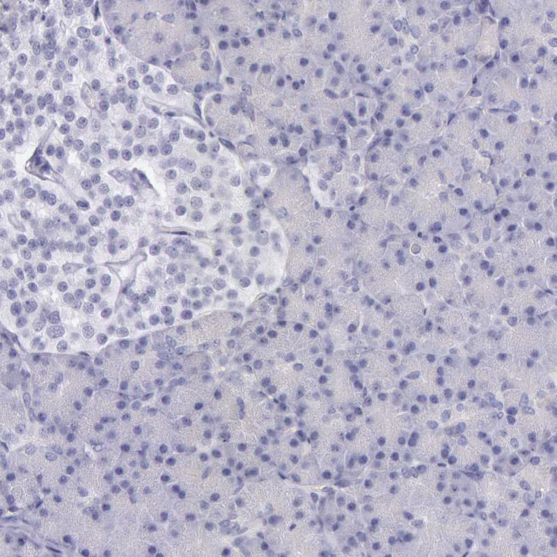 Staining of human pancreas shows no positivity in exocrine glandular cells as expected.