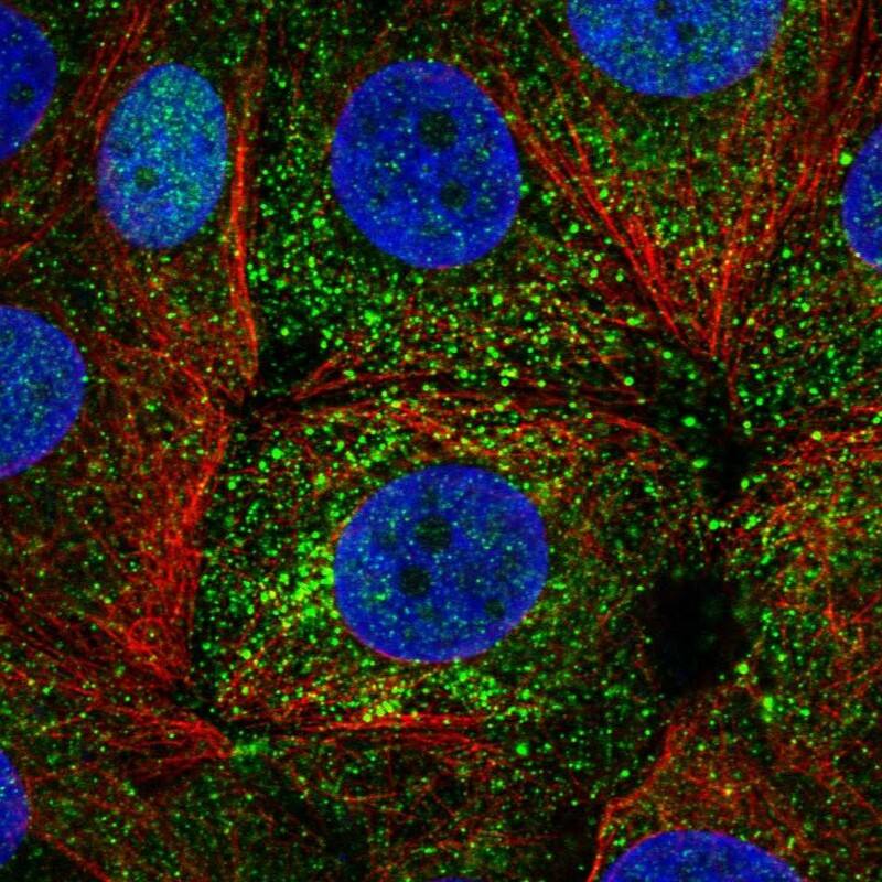 Staining of human cell line MCF7 shows localization to nucleus & vesicles.