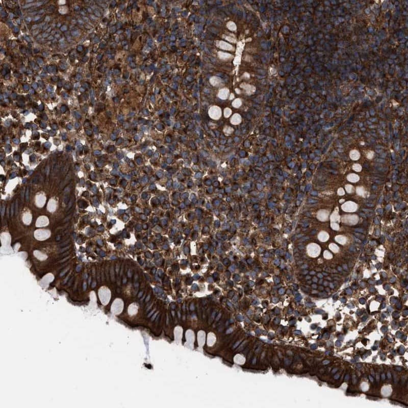 Immunohistochemistry-Paraffin EPS15R Antibody - BSA Free