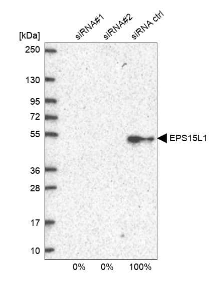 <b>Genetic Strategies Validation. </b>Analysis in U2OS cells transfected with control siRNA, target specific siRNA probe #1 and #2, using Anti-EPS15L1 antibody. Remaining relative intensity is presented.