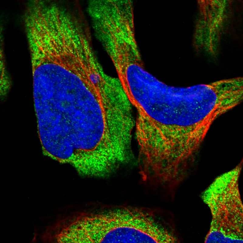 Staining of human cell line U-2 OS shows localization to cytosol & endoplasmic reticulum.