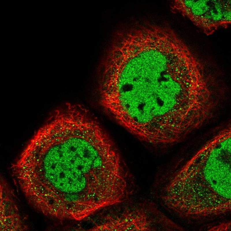 Staining of human cell line A-431 shows localization to nucleoplasm.