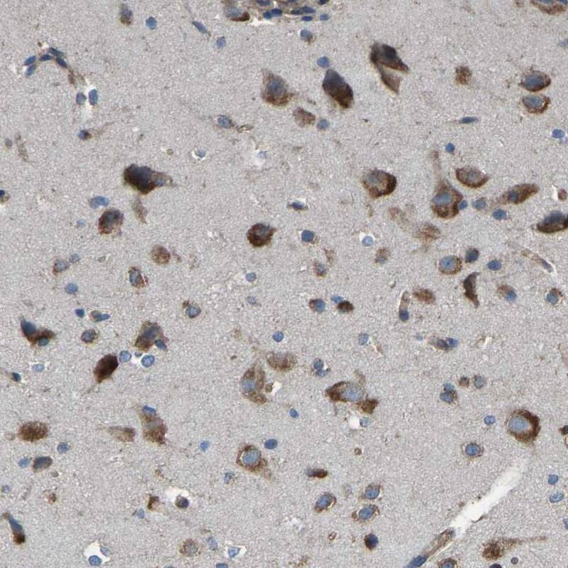 Staining of human cerebral cortex shows strong cytoplasmic positivity in neurons.