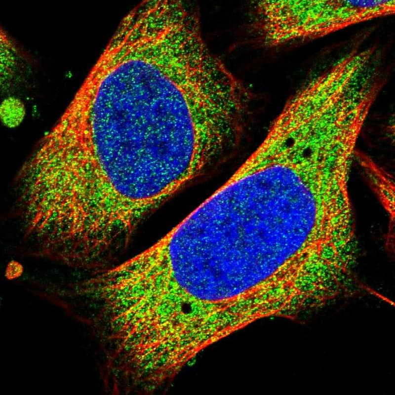 Staining of human cell line U-2 OS shows localization to cytosol.