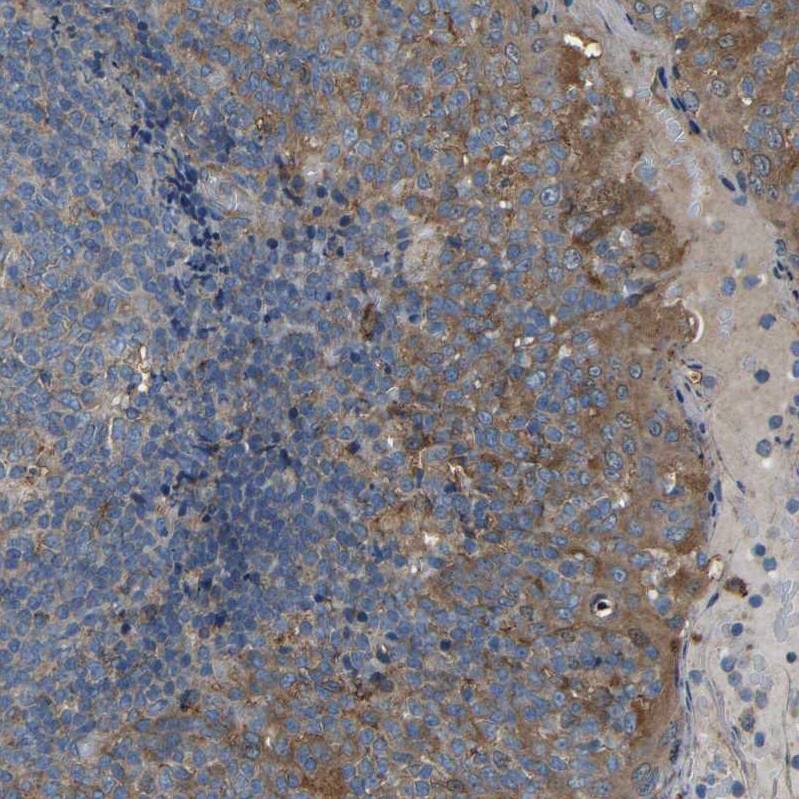 Staining of human tonsil shows strong cytoplasmic positivity in squamous epithelial cells.