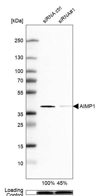 <b>Genetic Strategies Validation. </b>Analysis in SK-BR-3 cells transfected with control siRNA, target specific siRNA probe #1, using Anti-AIMP1 antibody. Remaining relative intensity is presented. Loading control: Anti-PPIB.