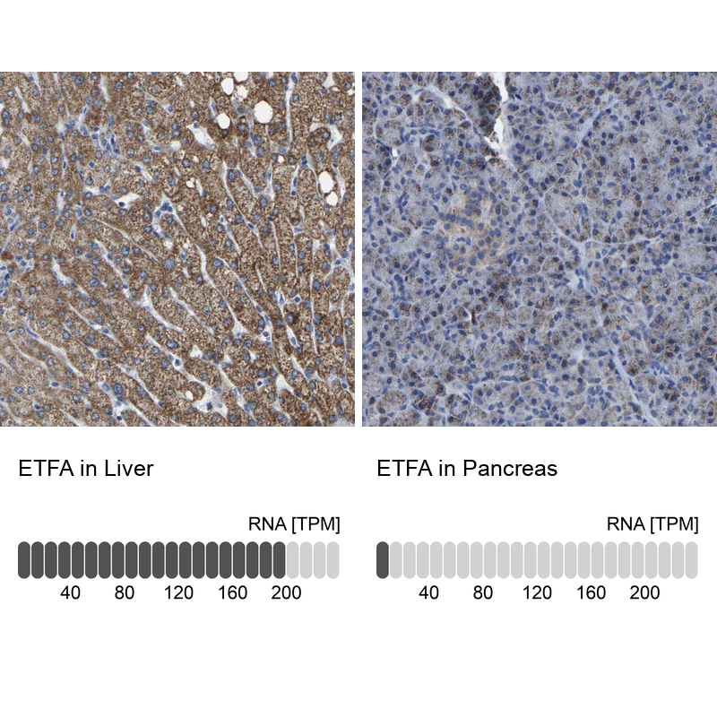 <b>Orthogonal Strategies Validation. </b>Analysis in human liver and pancreas tissues.