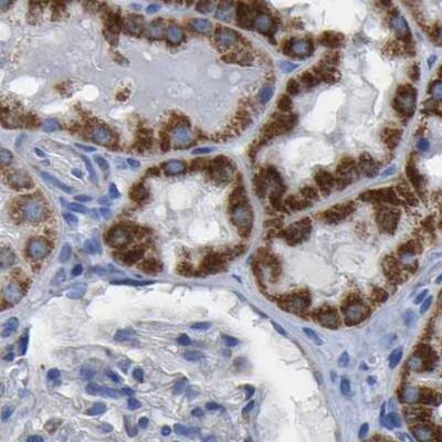 Staining of human kidney.