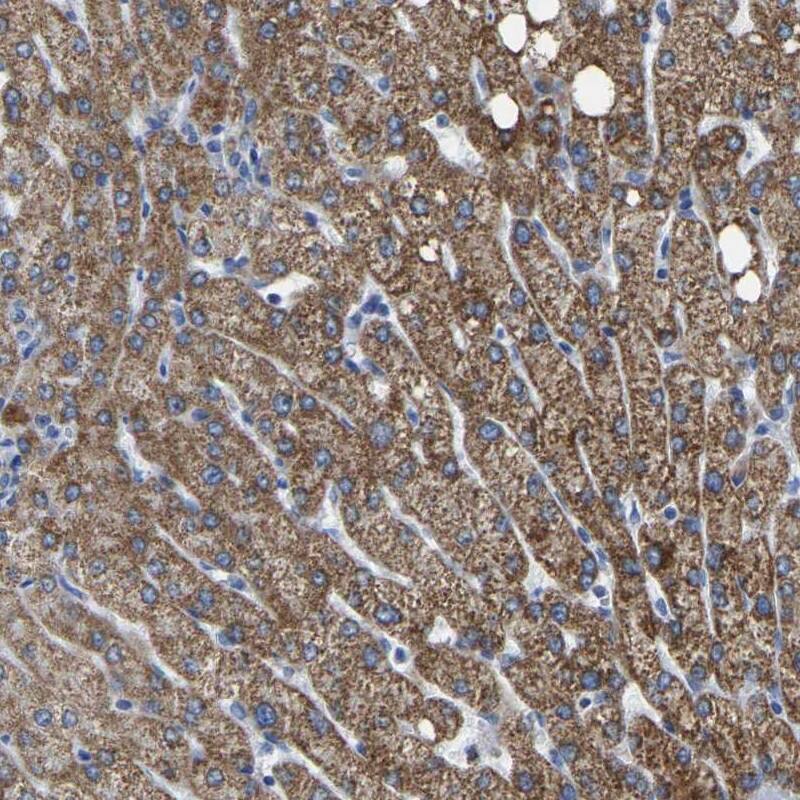 Staining of human liver shows high expression.