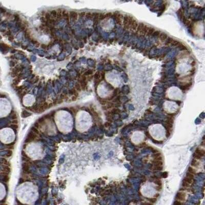 Staining of human colon.