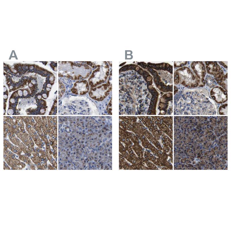 <b>Orthogonal Strategies Validation. </b>Staining of human colon, kidney, liver and pancreas HPA018993 (A) shows similar protein distribution across tissues to independent antibody HPA018990 (B).