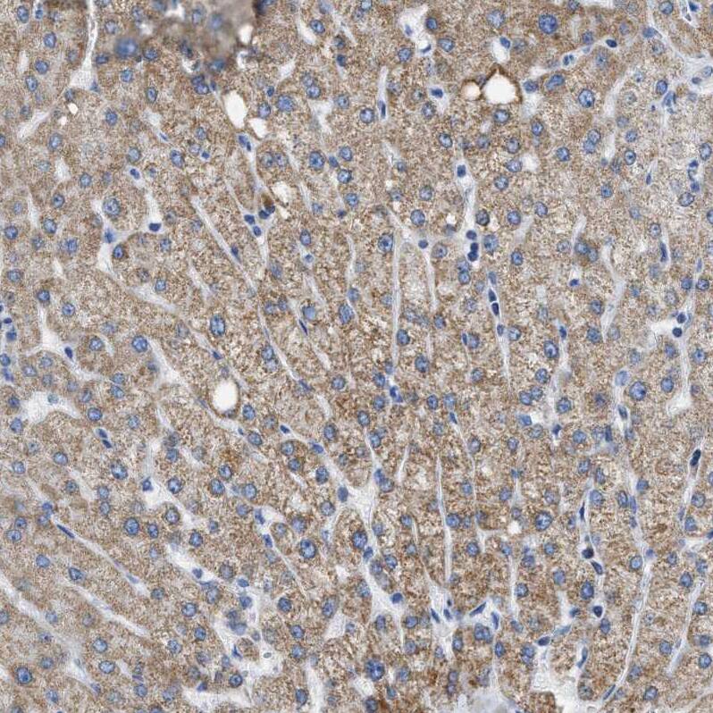 Staining of human liver shows moderate granular cytoplasmic positivity in hepatocytes.