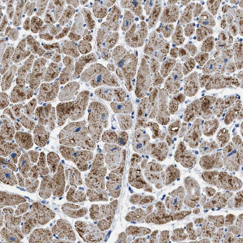 Staining of human heart muscle shows moderate granular cytoplasmic positivity in cardiomyocytes.