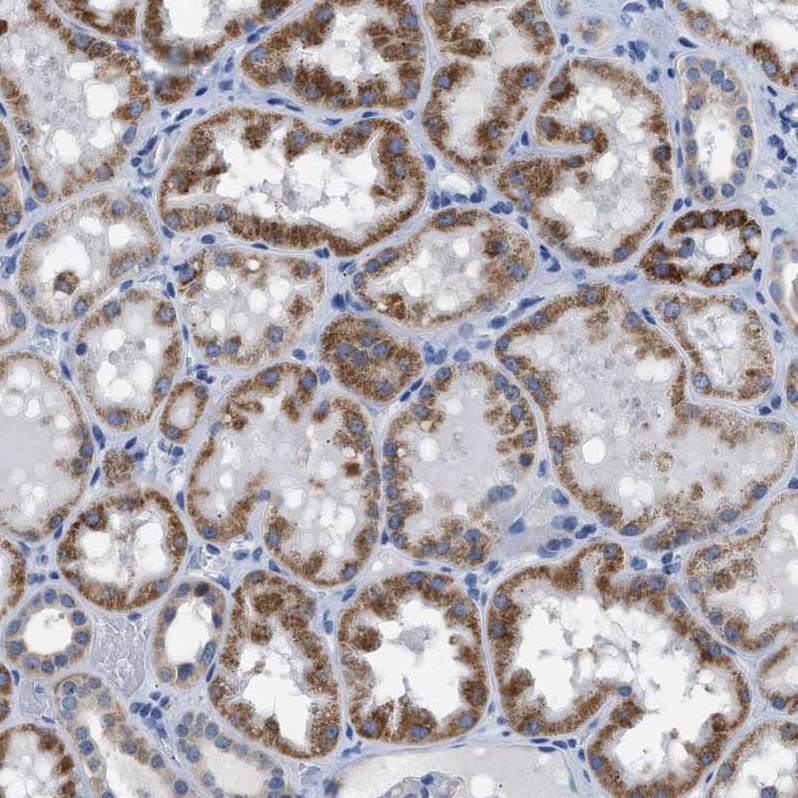 Staining of human kidney shows moderate granular cytoplasmic positivity in cells in tubules.