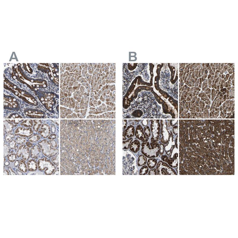 <b>Orthogonal Strategies Validation. </b>Staining of human gastrointestinal, heart muscle, kidney and liver HPA018996 (A) shows similar protein distribution across tissues to independent antibody HPA018990 (B).