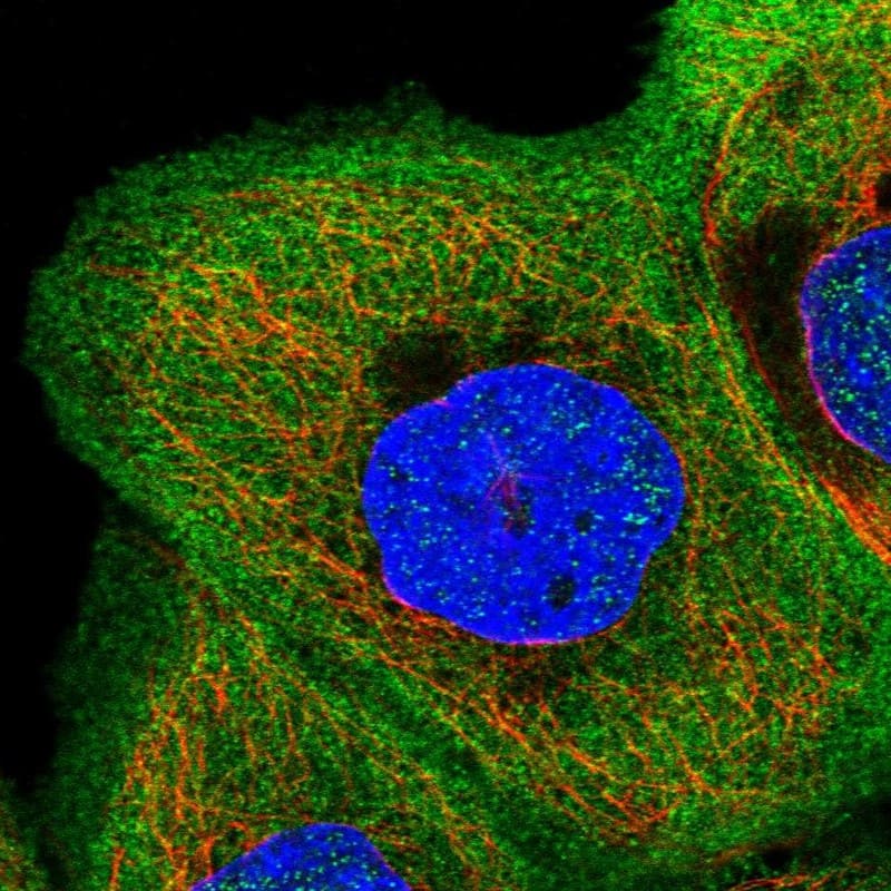 Staining of human cell line A-431 shows localization to plasma membrane & cytosol.
