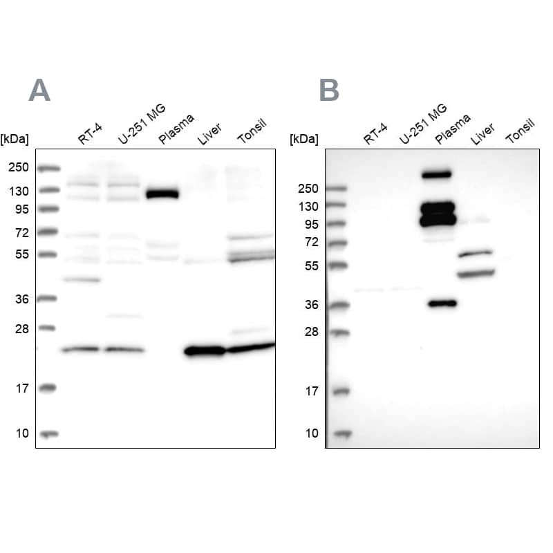 Western Blot REXO1 Antibody