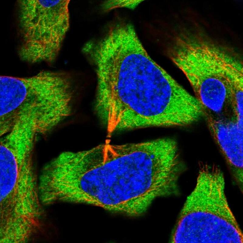 Staining of human cell line U-2 OS shows localization to cytosol.