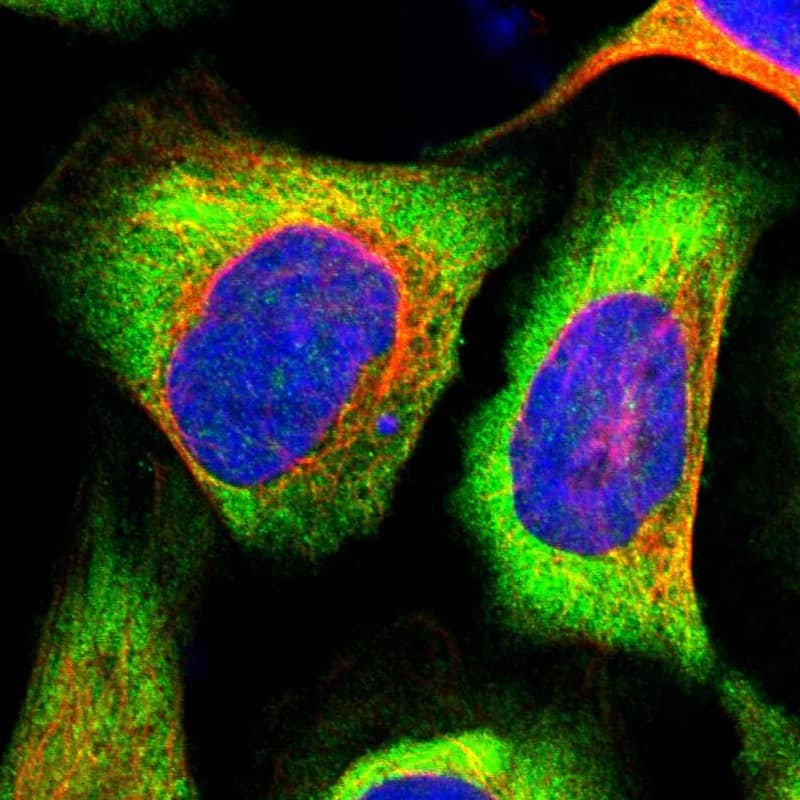 Staining of human cell line U-2 OS shows localization to cytosol.