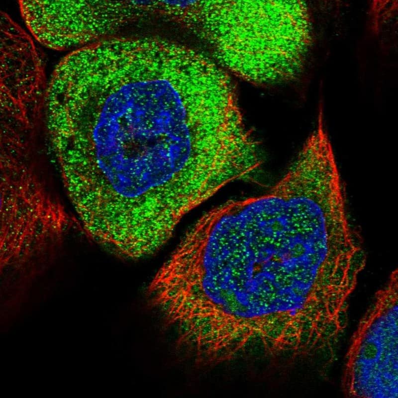 Staining of human cell line A-431 shows positivity in nucleus & cytoplasm.