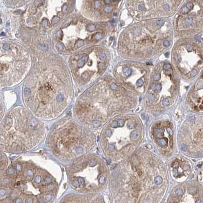 Staining of human kidney.