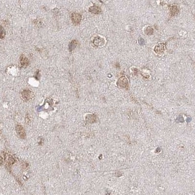 Staining of human cerebral cortex.