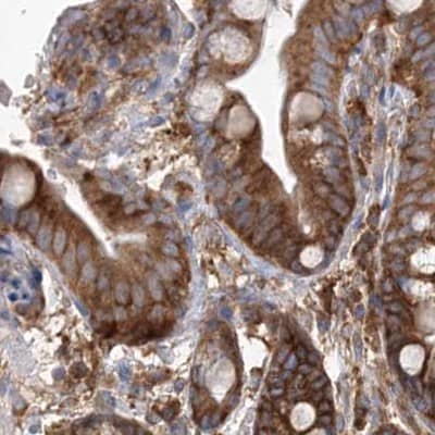 Staining of human colon.