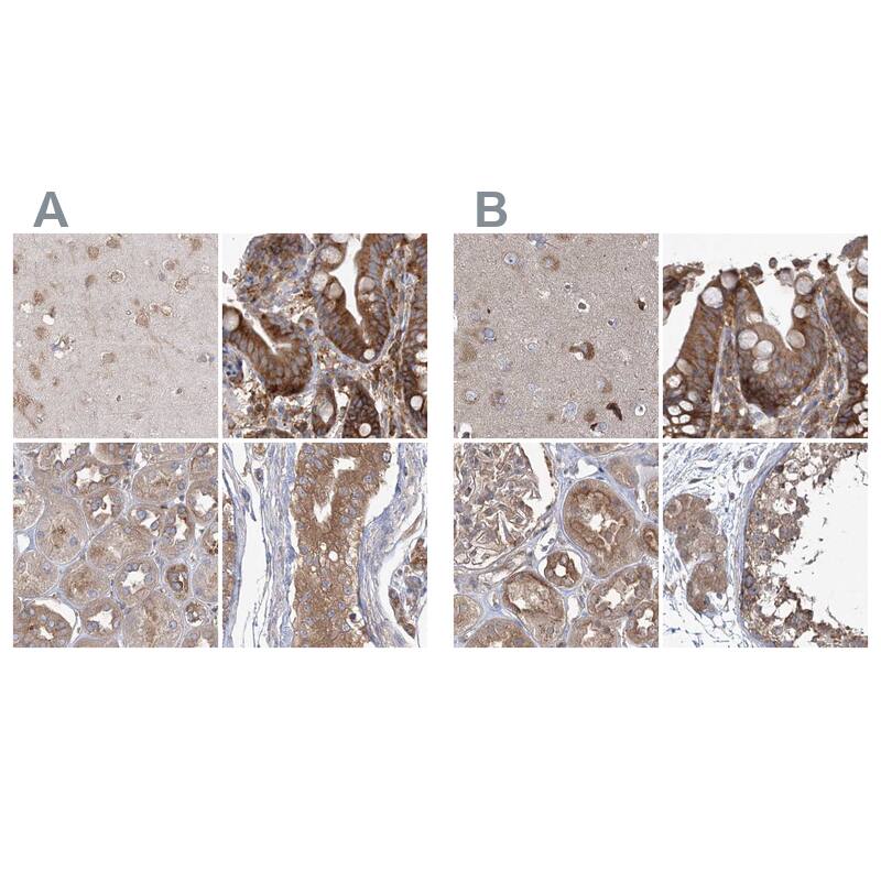 <b>Orthogonal Strategies Validation. </b>Staining of human cerebral cortex, colon, kidney and testis HPA038315 (A) shows similar protein distribution across tissues to independent antibody HPA038316 (B).