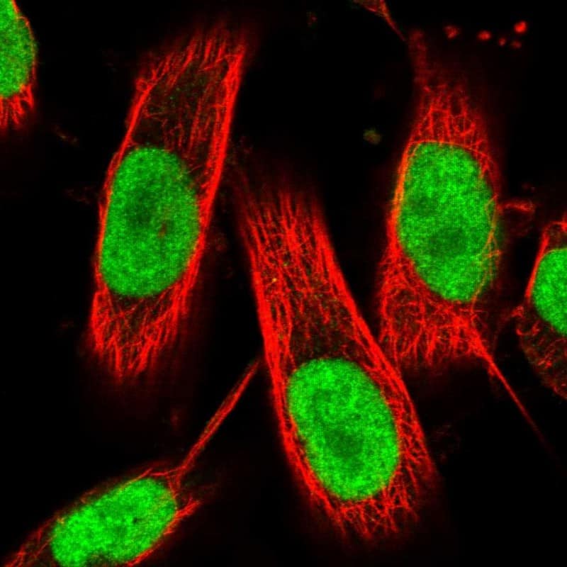 Staining of human cell line U-251 MG shows localization to nucleoplasm.