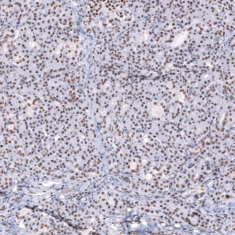 Immunohistochemistry-Paraffin SNRPN Antibody