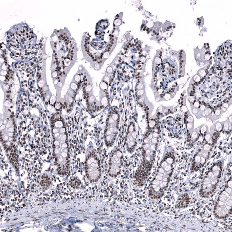 Immunohistochemistry-Paraffin SNRPN Antibody